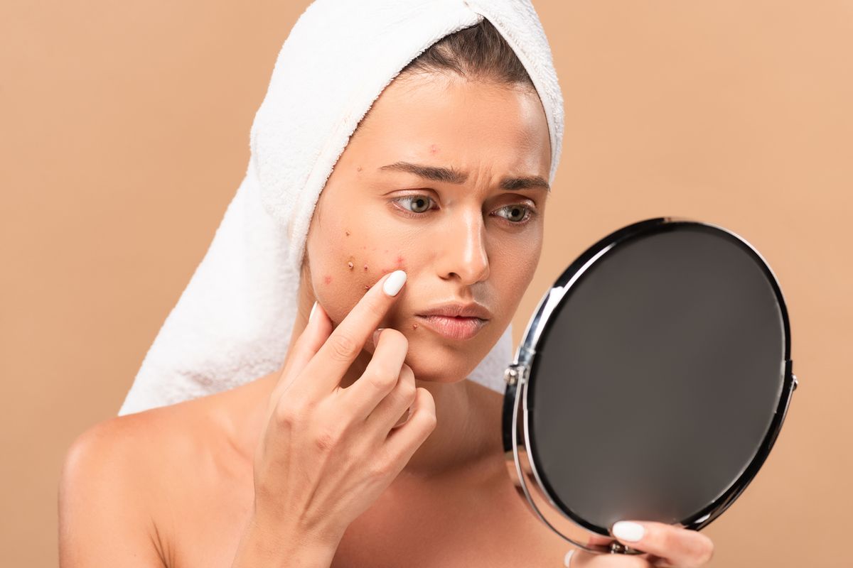 Foto: Die besten Tipps zur Hautpflege bei Winterakne.