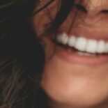 Warum eine professionelle Zahnreinigung unverzichtbar ist