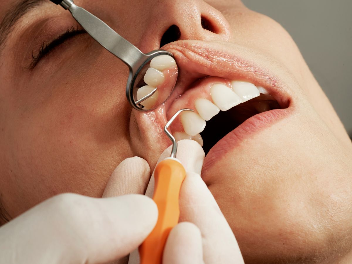 Foto: Warum eine professionelle Zahnreinigung unverzichtbar ist.